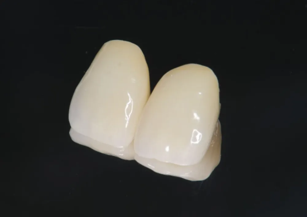 オールセラミックス