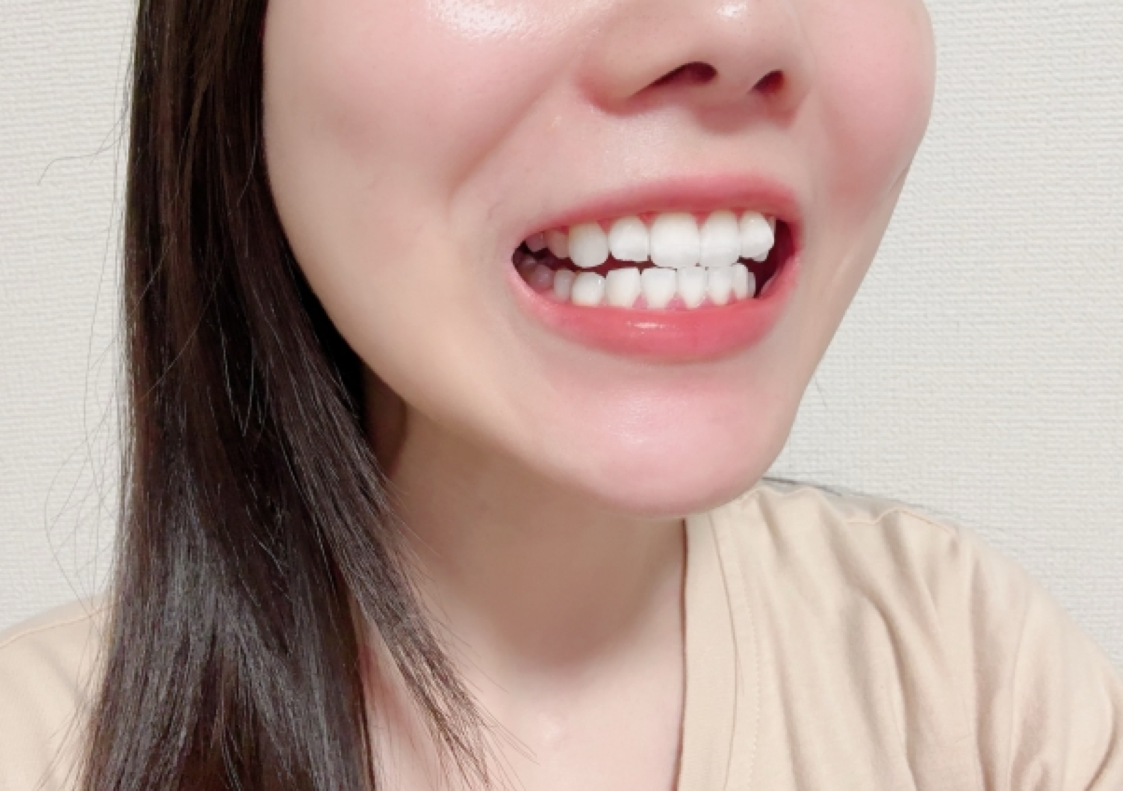 噛み合わせまで綺麗に