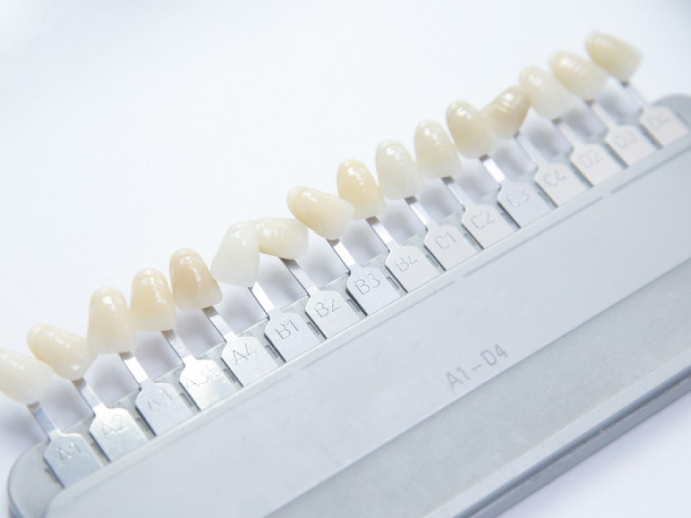 ライフスタイルに合わせたホワイトニングメニュー