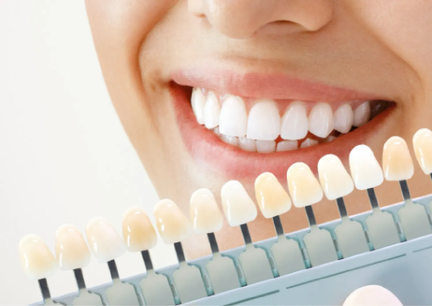 デュアルホワイトニング